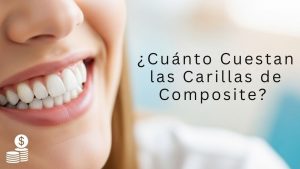 carillas de composite precio