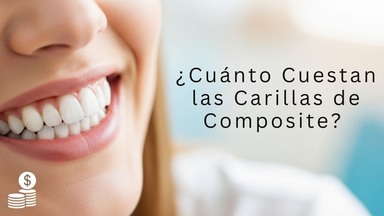 carillas de composite precio