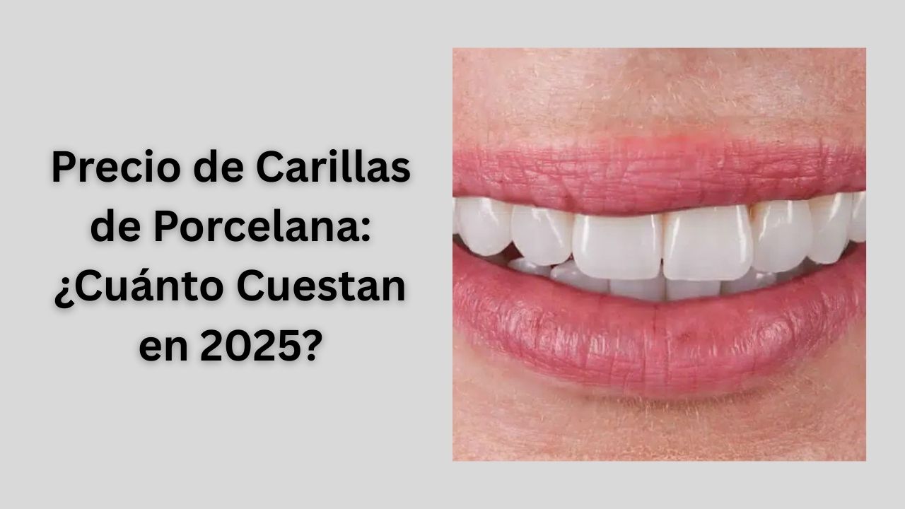 carillas de porcelana precio