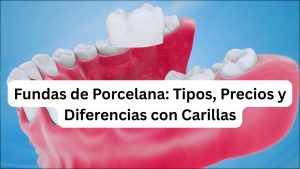fundas de porcelana