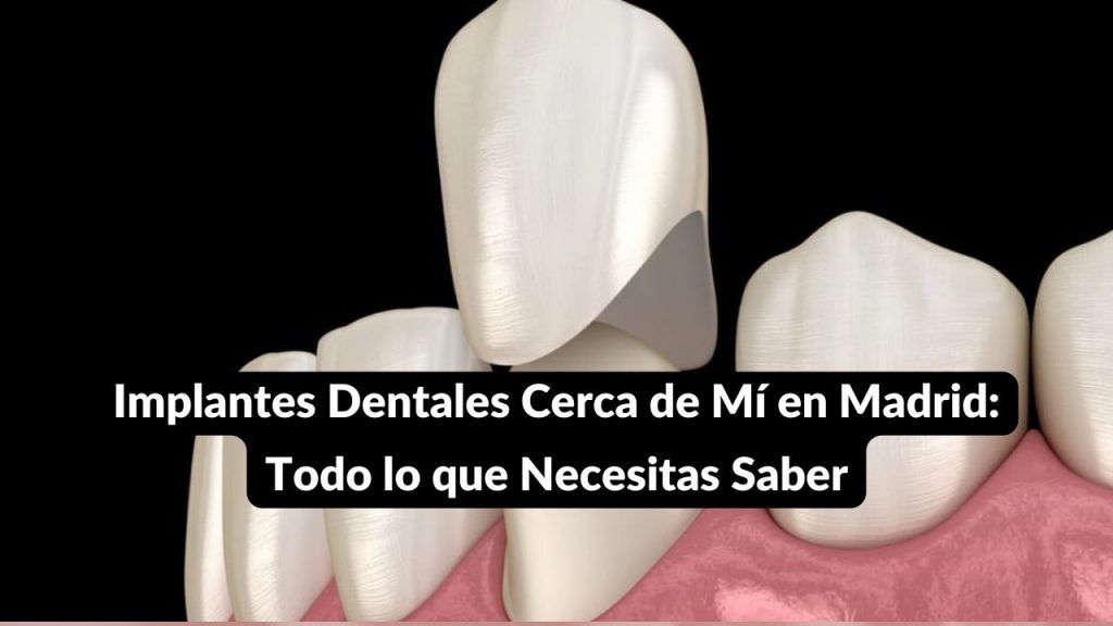 corona dental colocación