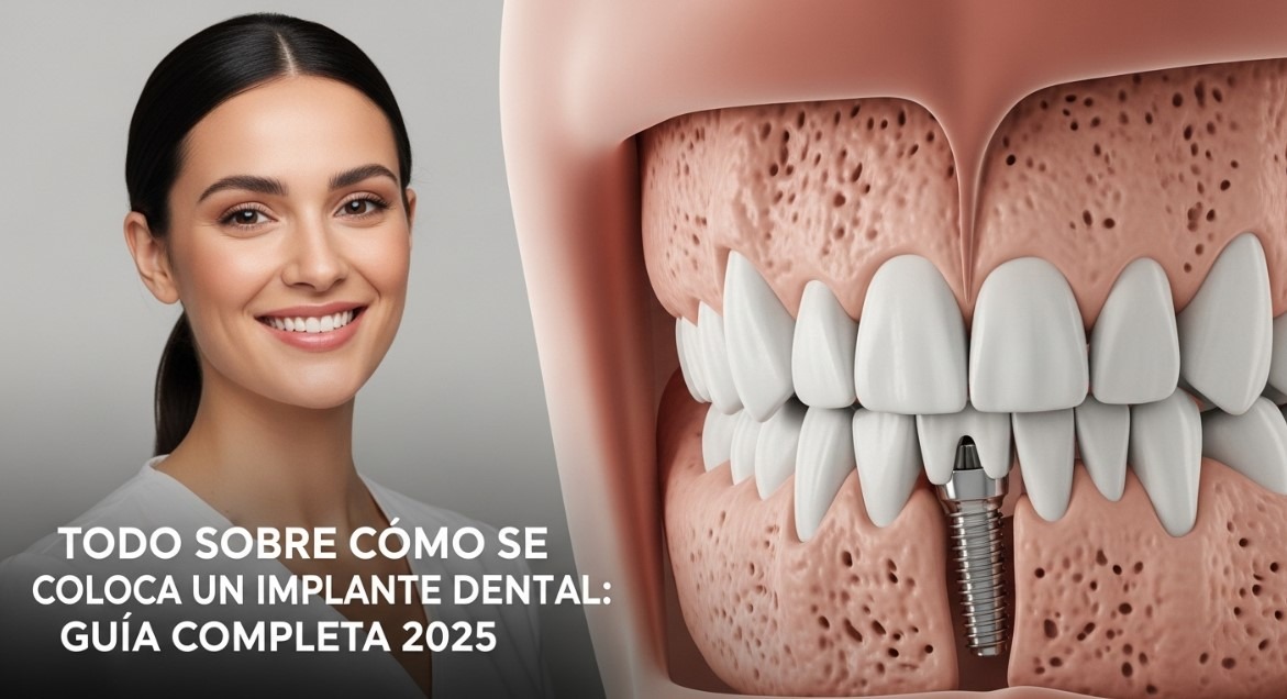 Mujer sonriente e ilustración de implante dental