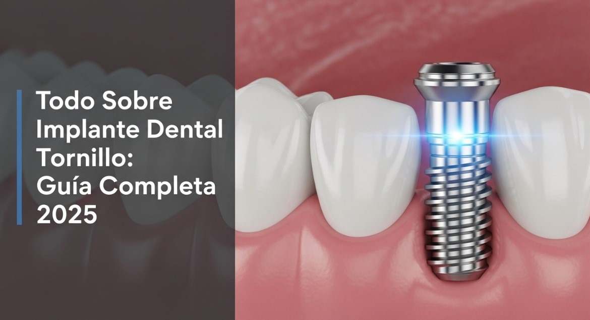 Implante dental, tornillo y dientes sanos. Guía completa.